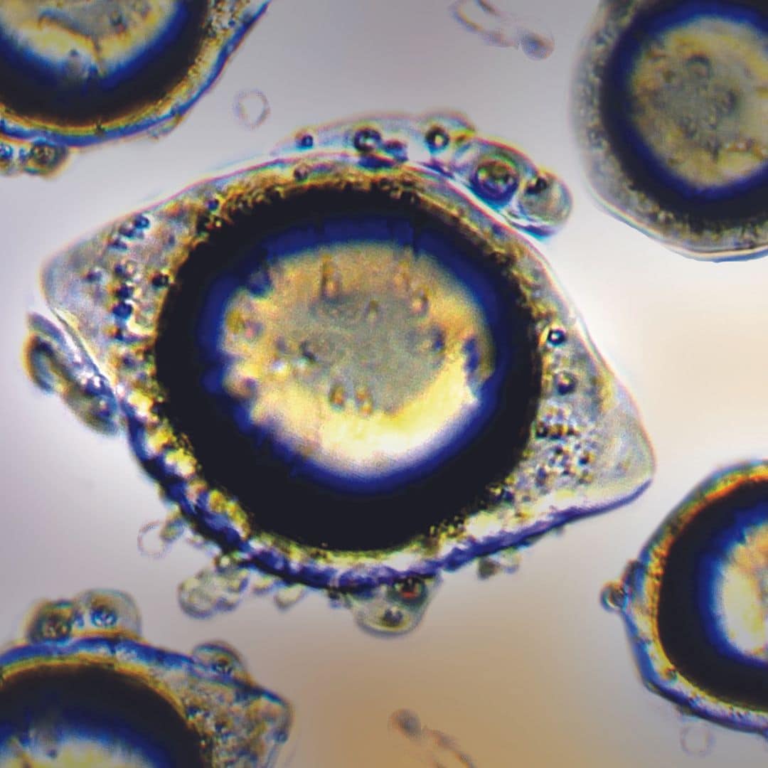 Mikroenkapsuliran Koencim Q10