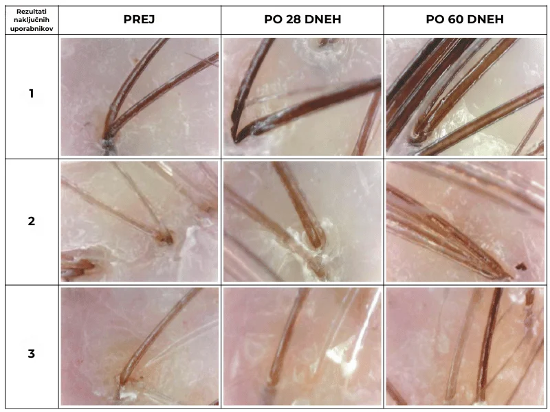 collagen lasje prej potem (800 x 600 px)