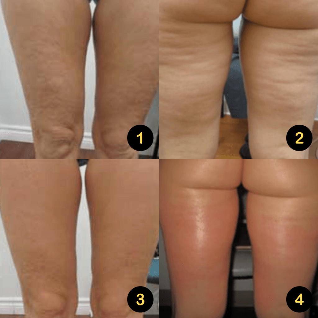 ELP: Celuline (2+1 gratis)