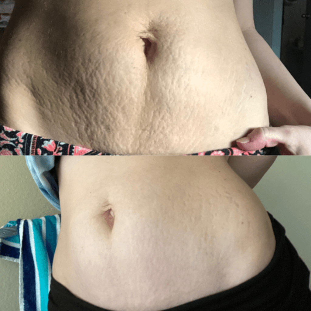 ELP: Celuline (2+1 gratis)