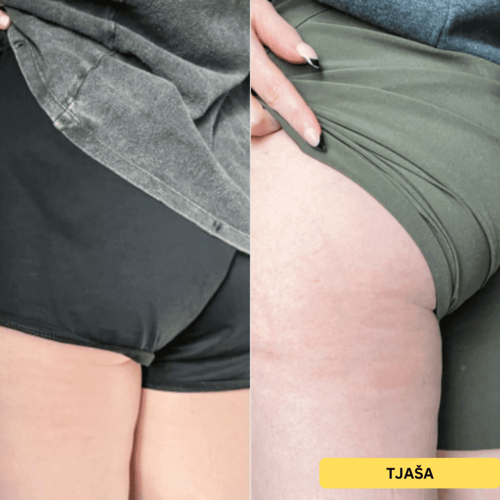 ELP: Summer Line (2+1 gratis)