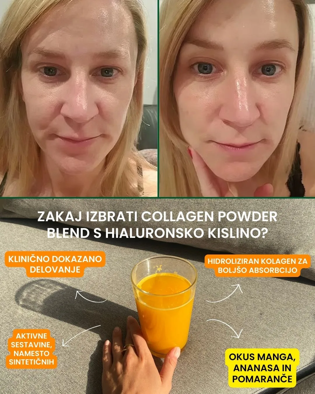 Biostile Collagen Powder + Hyaluronic Acid, 30 vrečk