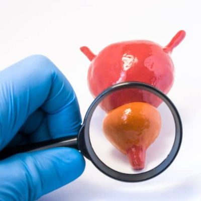 prostata biostile urovit compolet Urovit Complet